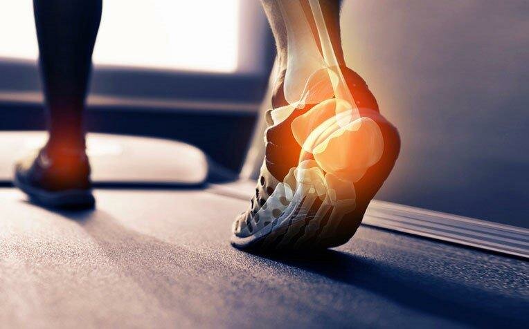 THE CAUSES OF HEEL PAIN AFTER RUNNING - fayybek